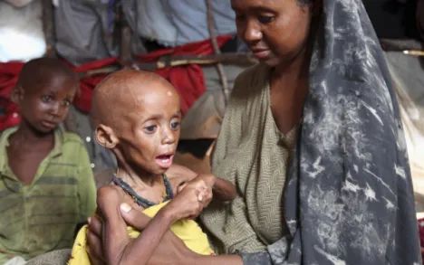 Tirada carruurta Somaliya ee la il-daran nafaqo darrada oo sii kordheysa